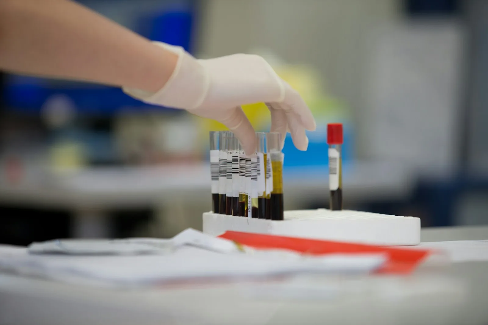 Cholesterolio kraujo tyrimas laboratorijoje — 7 priežastys, kodėl LDL pakyla net be netinkamos mitybos